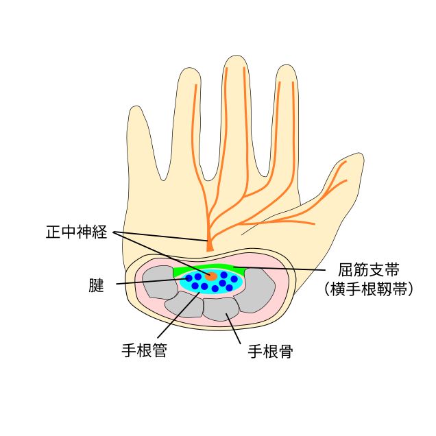 手根管断面