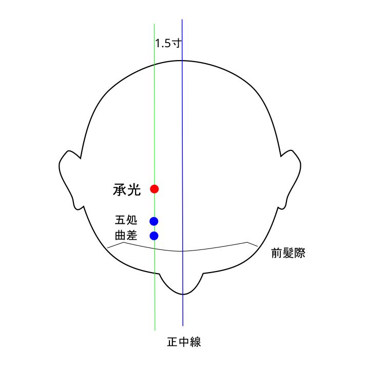 承光穴