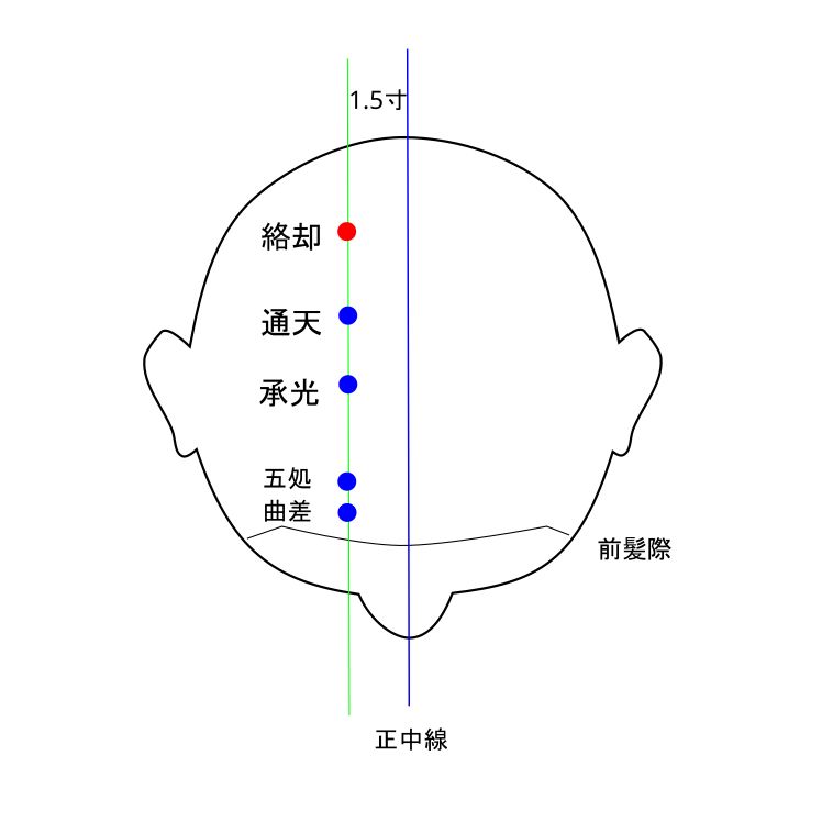 絡却穴のイラスト