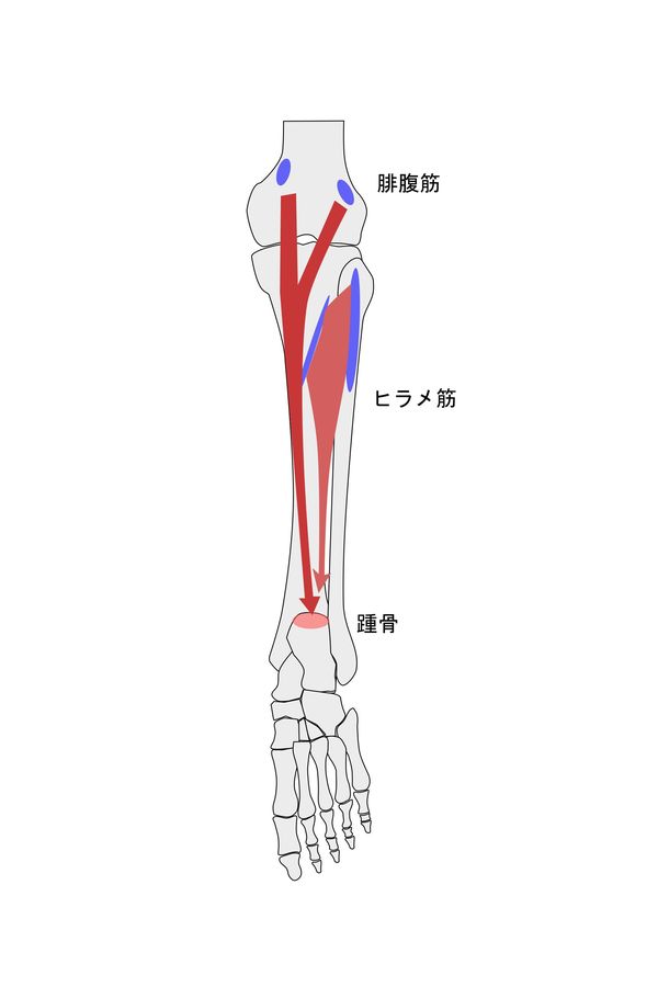 下腿三頭筋炎イラスト