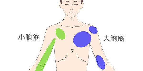 大胸筋・小胸筋のトリガーポイントイラスト