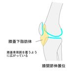 膝蓋下脂肪体と膝関節伸展位